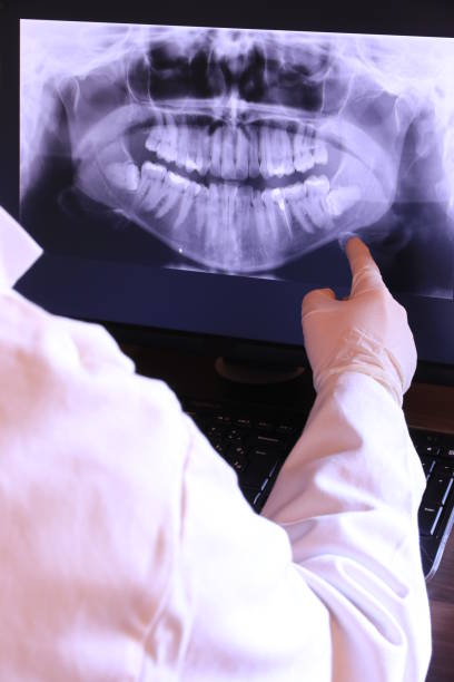 Best Emergency Treatment for Dental Infections or Abscesses in Chester Heights, PA