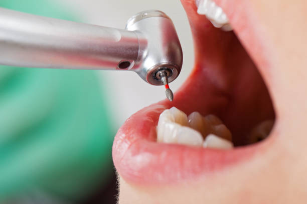 Best Emergency Dental Care for Broken or Chipped Teeth in Chester Heights, PA